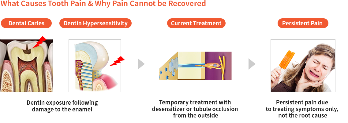 What Causes Tooth Pain & Why Pain Cannot be Recovered